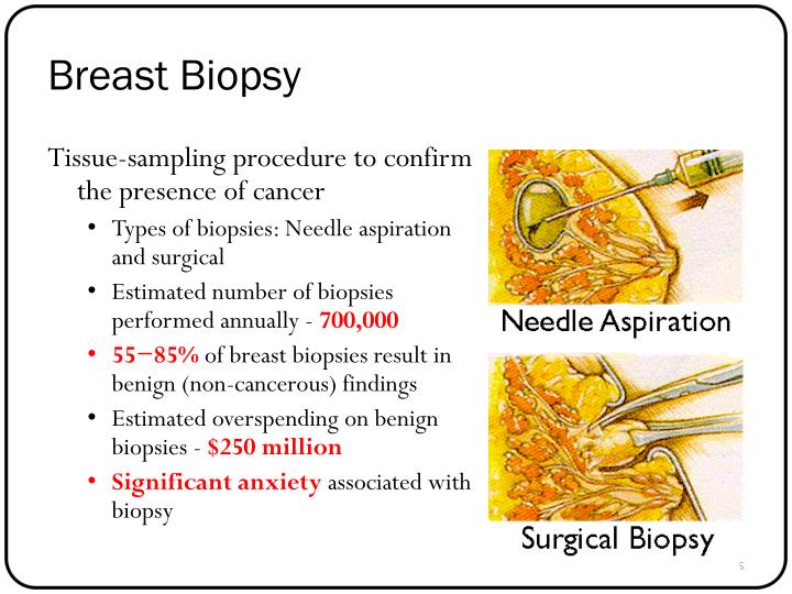 breast cancer biopsy types Sexy balls positions