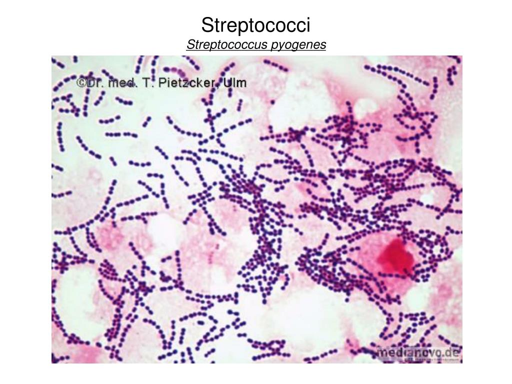 streptococci streptococcus pyogenes.