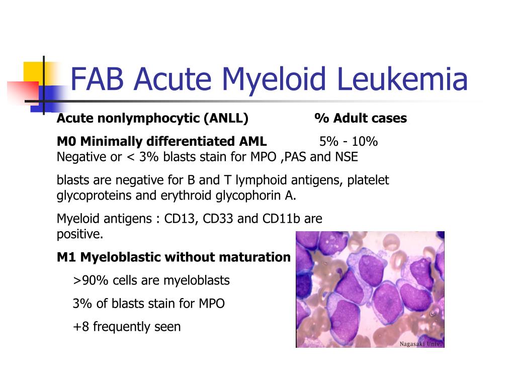 PPT ACUTE LEUKEMIA PowerPoint Presentation, free download ID4250146