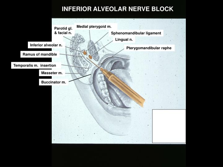 Inferior Alveolar Nerve Block Anatomy