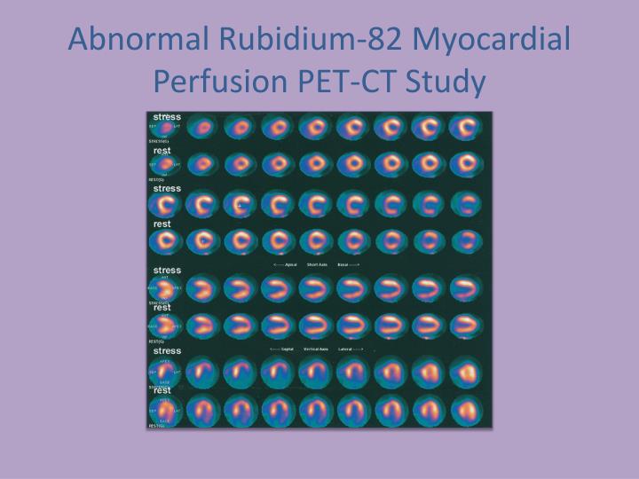 PPT - Diagnostic Accuracy of Rubidium-82 Myocardial Perfusion Imaging ...
