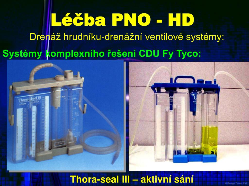 PPT - Pneumothorax PowerPoint Presentation, free download - ID:4256389