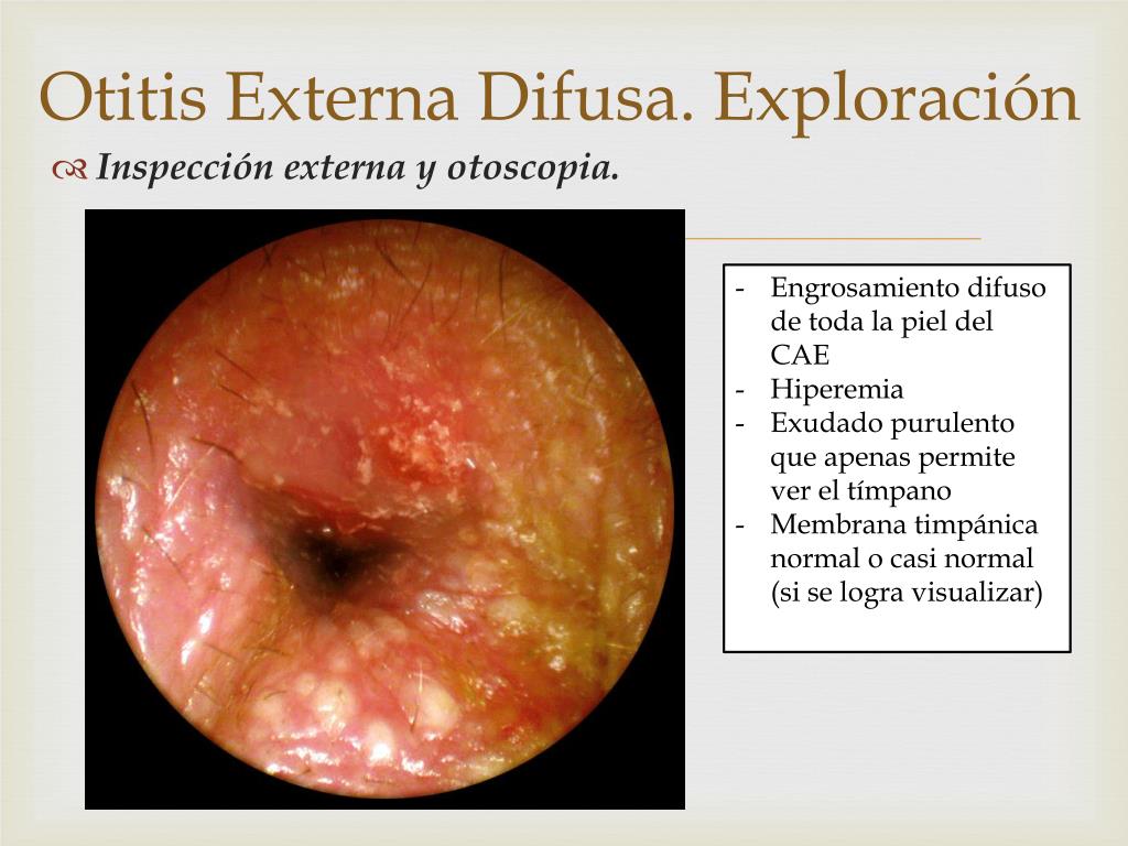 Otitis gatos tratamiento casero