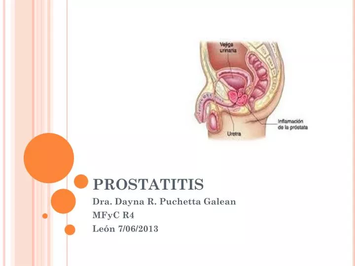 Tampons a prosztatitis