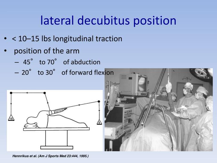 PPT Shoulder arthroscopy PowerPoint Presentation ID4270378