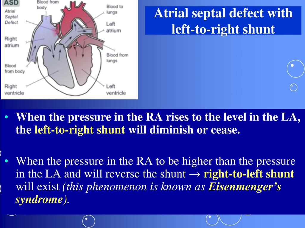 Right to left cardiac shunt symptoms