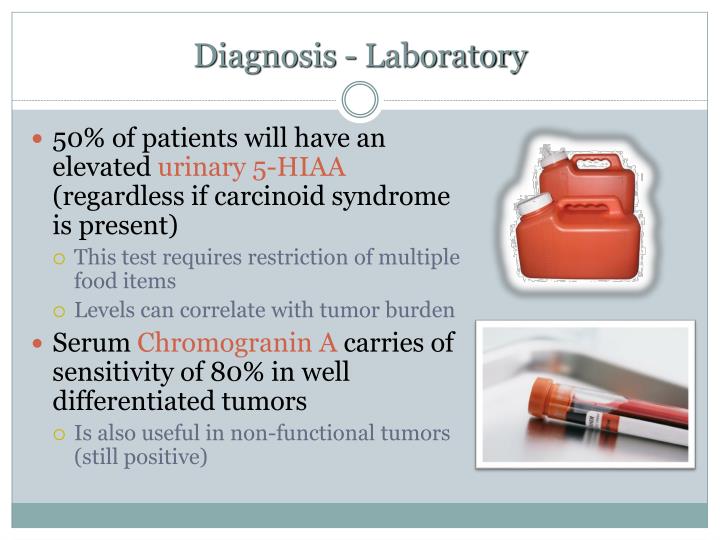 PPT Diagnosis & Surgical Management of Carcinoid Tumors PowerPoint PPT Diagnosis & Surgical Management of Carcinoid Tumors PowerPoint