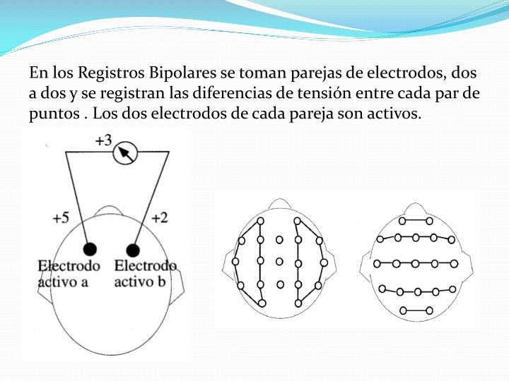 PPT - ELECTROENCEFALOGRAMA PowerPoint Presentation - ID:4278873