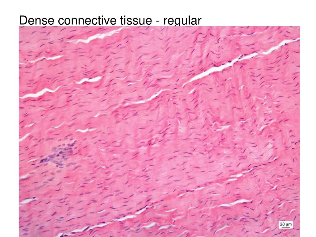 Плотная оформленная ткань сухожилия. Dense Irregular connective Tissue. Плотная волокнистая соединительная ткань под микроскопом. Плотная оформленная волокнистая соединительная ткань. Плотная соединительная ткань под микроскопом.