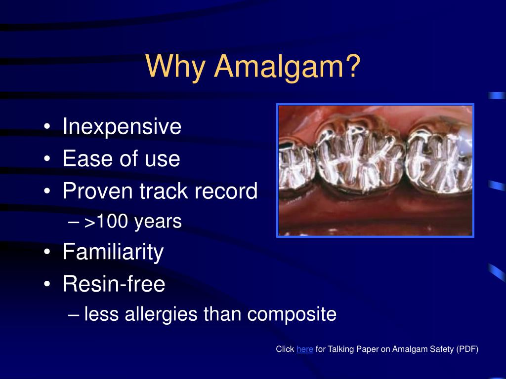 PPT Dental Amalgam PowerPoint Presentation, free download ID4290502