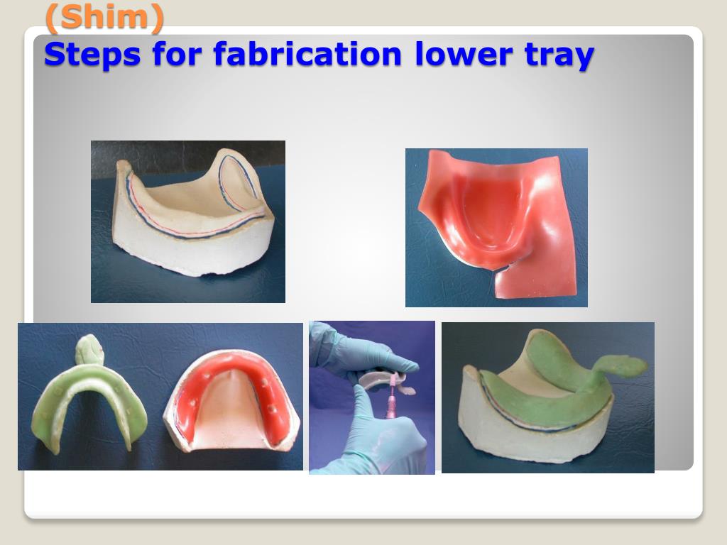PPT Impression tray and impression technique PowerPoint Presentation ID4292535