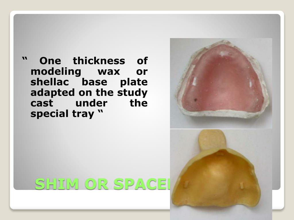 PPT Impression tray and impression technique PowerPoint Presentation