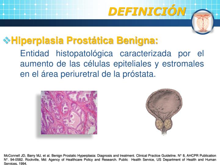 PPT Hiperplasia Prostática Benigna Etiología