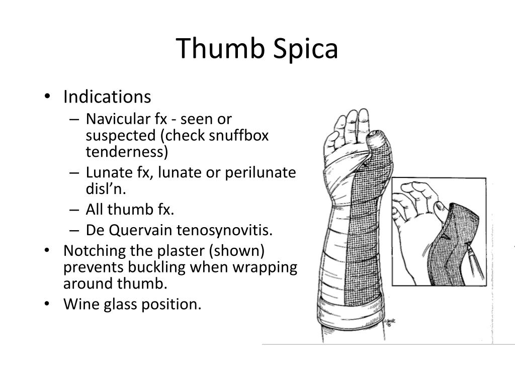 thumb spica orthoglass