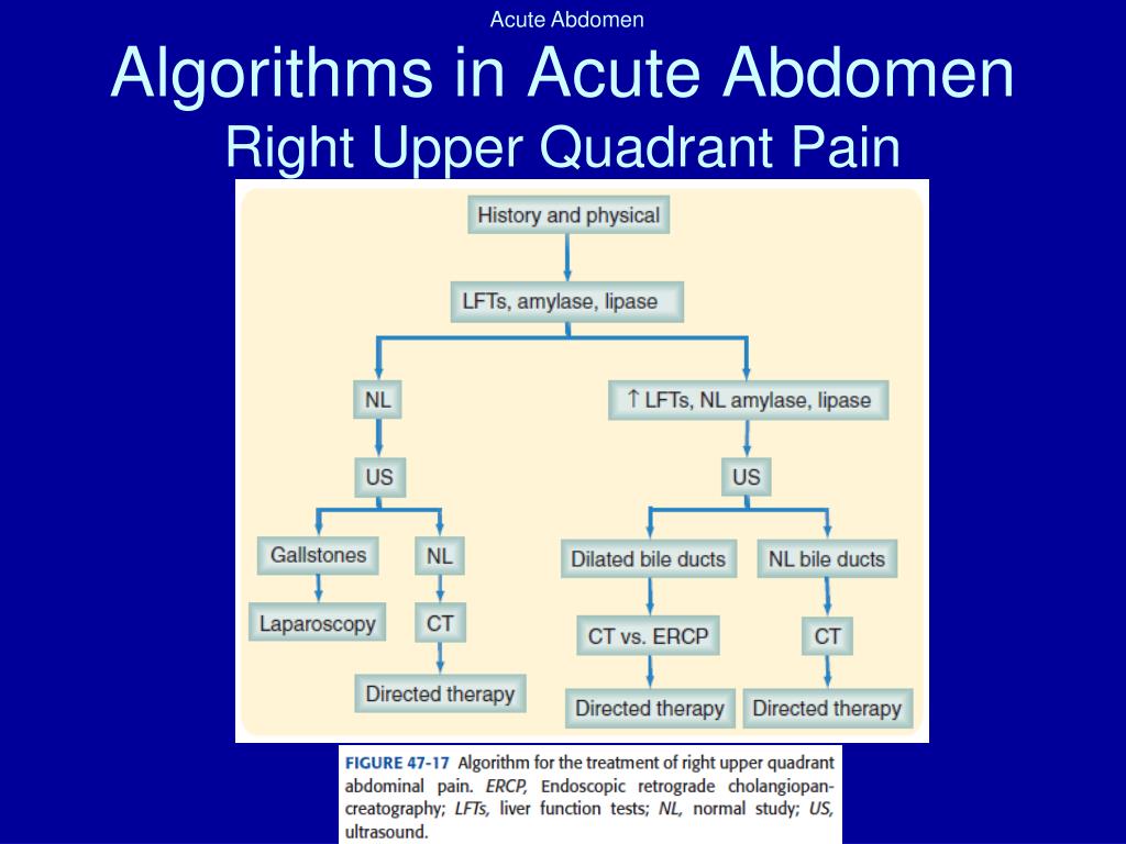 Acute перевод. Abdominal Pain algorithm. Acute abdomen algorithm. Algorithm for acute abdominal Pain.