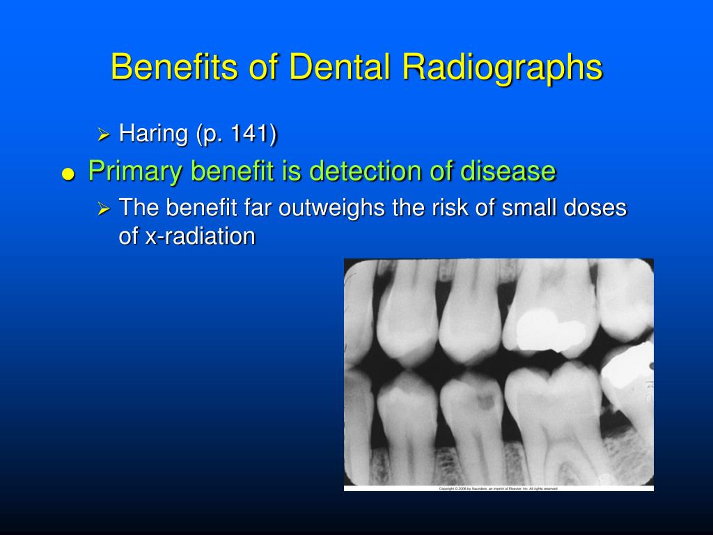 PPT Dental Radiographs and the Dental Radiographer PowerPoint