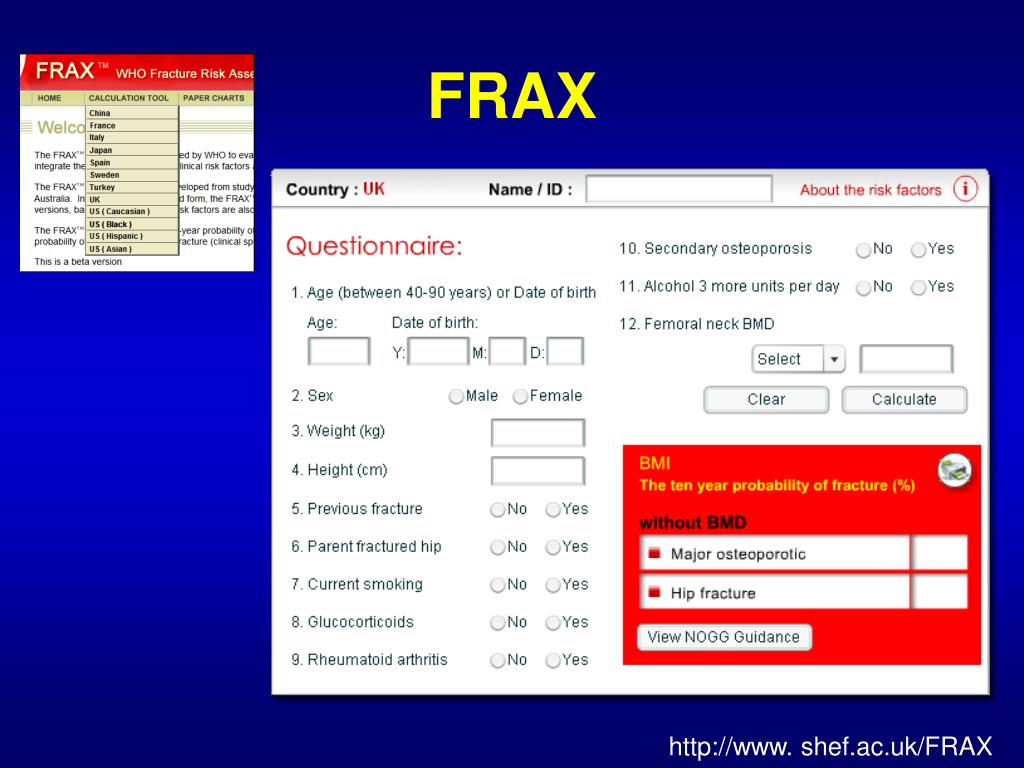 Frax Testing PPT - Osteoporoz Tanı ve Tedavi Prensipleri PowerPoint Presentation ...