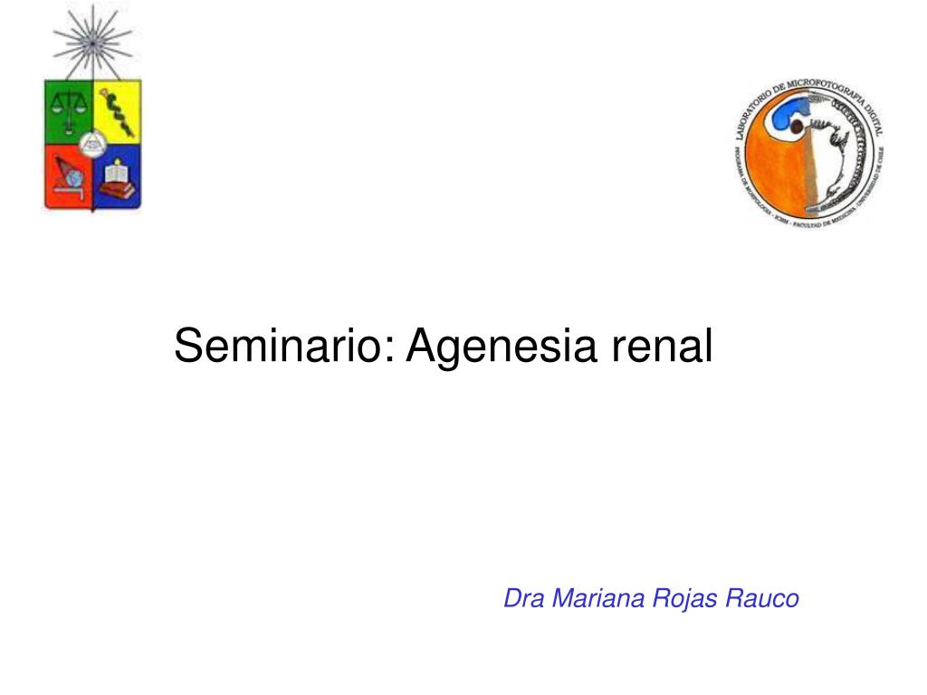 agenesia renal unilateral definicion