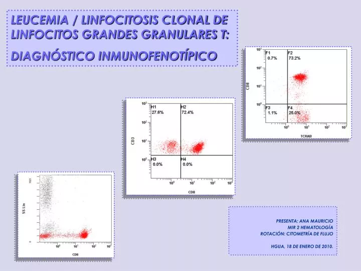 Leucemia de linfocitos grandes granulares nk