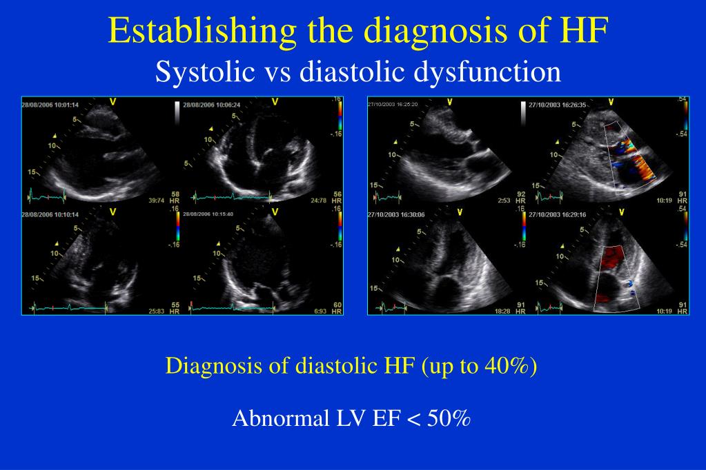 PPT - THE ECHOCARDIOGRAPHIC EVALUATION OF THE HEART FAILURE PATIENT PowerPoint Presentation - ID ...