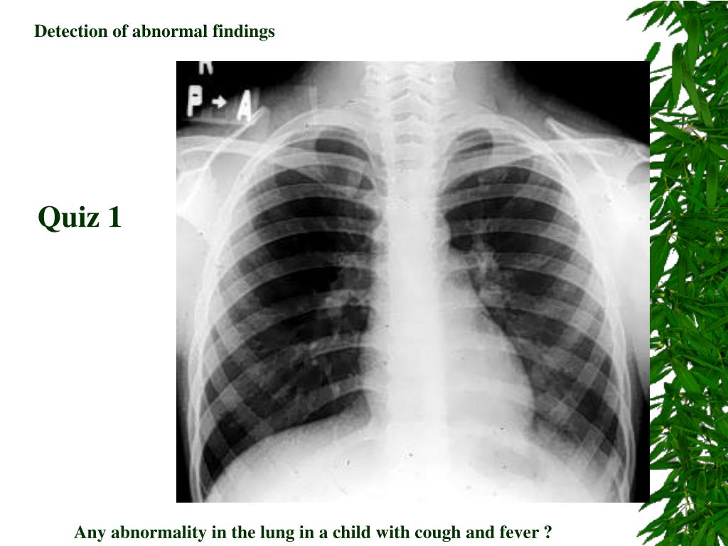 Chest surgery Photos - ppt download