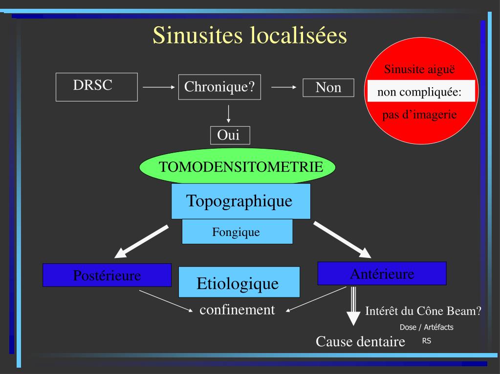 Sinusites chroniques – Dr Lasfargue