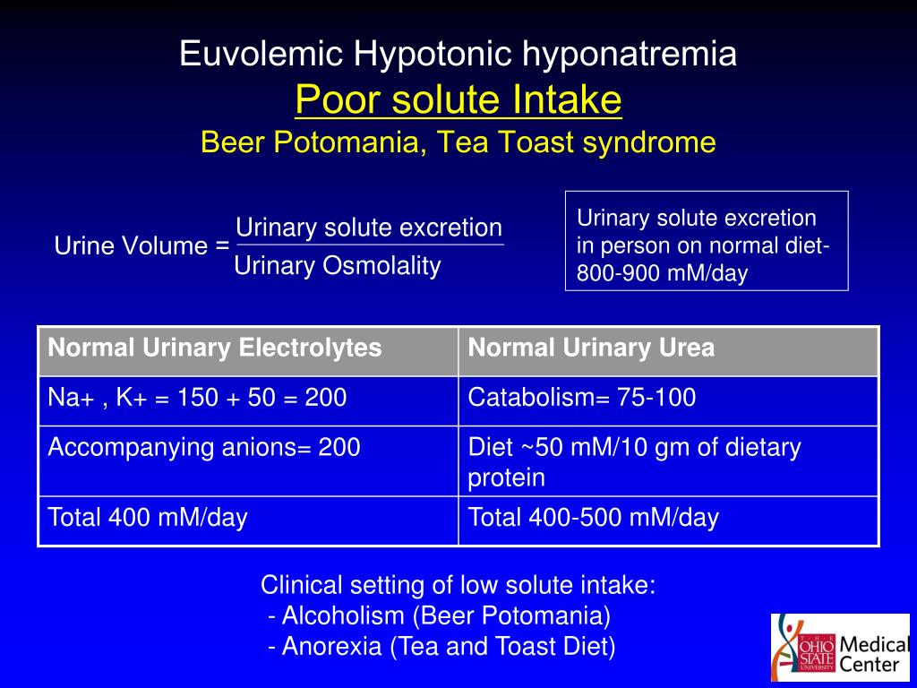 Hyponatremia Presentation