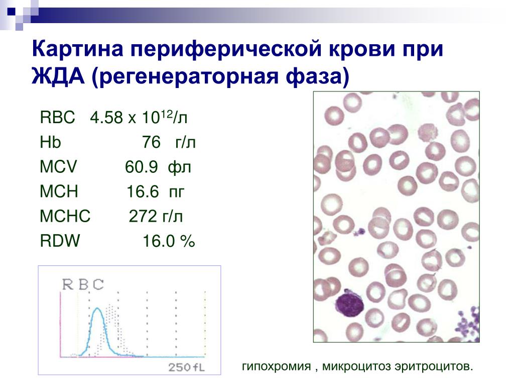 При железодефицитной анемии в анализе крови наблюдаются