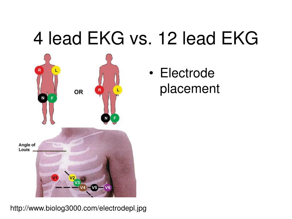 PPT - EKG PowerPoint Presentation, free download - ID:4371250