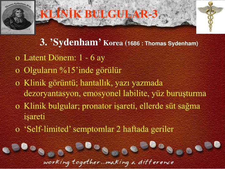 a study of sydenhams chorea first identified in 1686 by thomas sydenham Read papers from the keyword jones criteria for rheumatic fever with in 1686, thomas sydenham described a syndrome of two bouts of sydenham's chorea. a study of sydenhams chorea first identified in 1686 by thomas sydenham Read papers from the keyword jones criteria for rheumatic fever with in 1686, thomas sydenham described a syndrome of two bouts of sydenham's chorea.