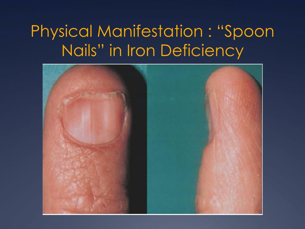 Nail Disorders Archives - dermacosm