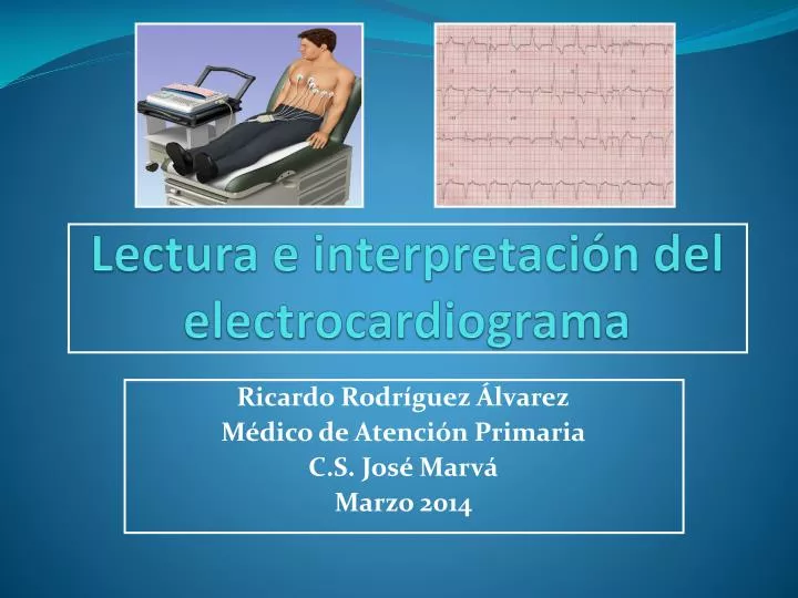lectura e interpretaci n del electrocardiograma n.