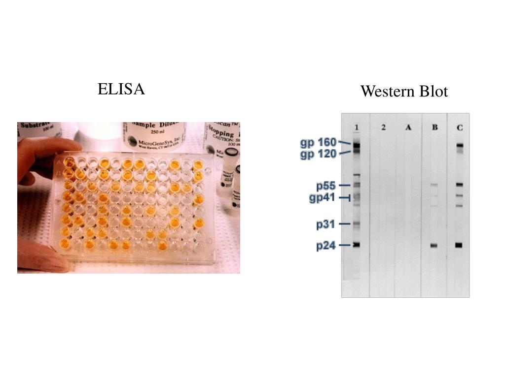 sds page vs western blot vs elisa sds page vs western blot vs elisa