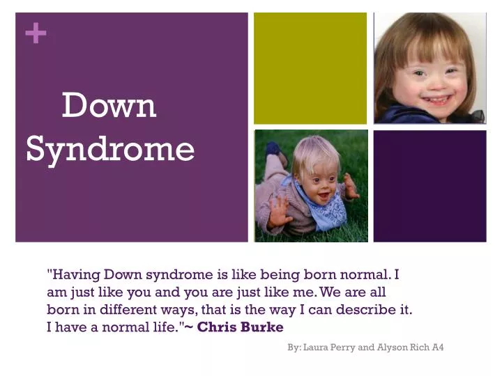 PPT Down Syndrome PowerPoint Presentation free download ID:4397584