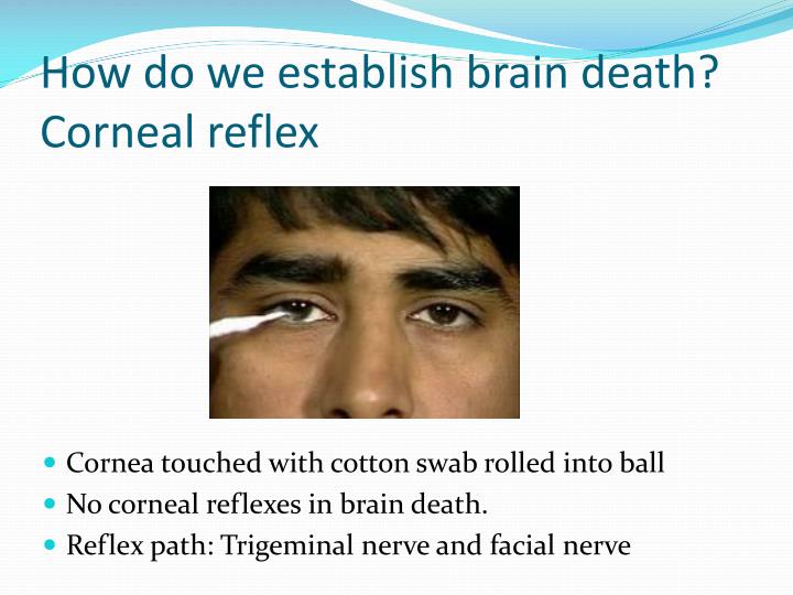 PPT Brain Death PowerPoint Presentation ID4403695