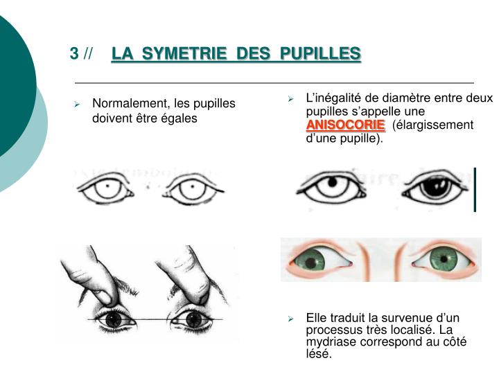 Polycorie Deux Pupilles Dans Un Oeil PPT - Soins infirmiers en neuroréanimation LA SURVEILLANCE NEUROLOGIQUE