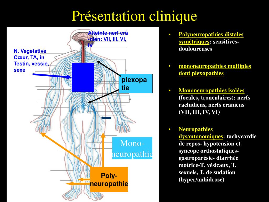 PPT - Neuropathies périphériques PowerPoint Presentation, free download ...