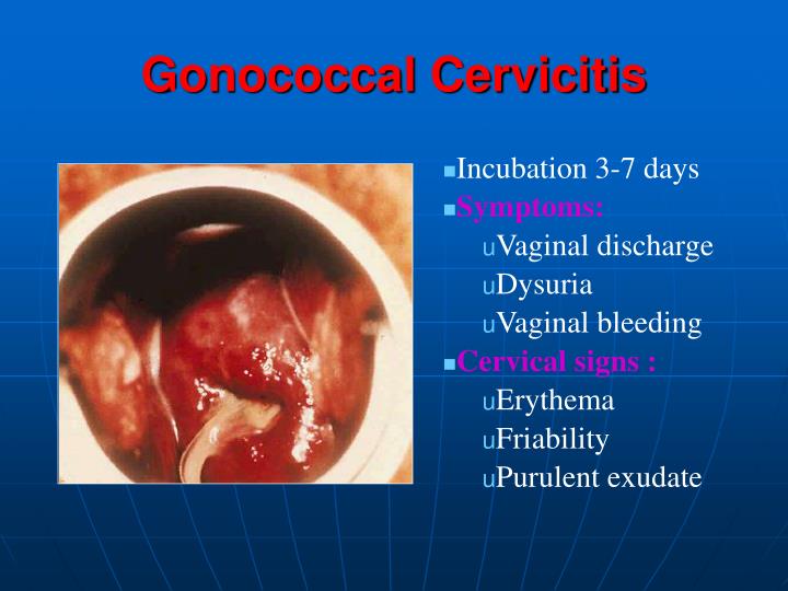 PPT - Dr.MOHAMED NASR Lecturer Of Dermatology & Venereology Zagazig ...