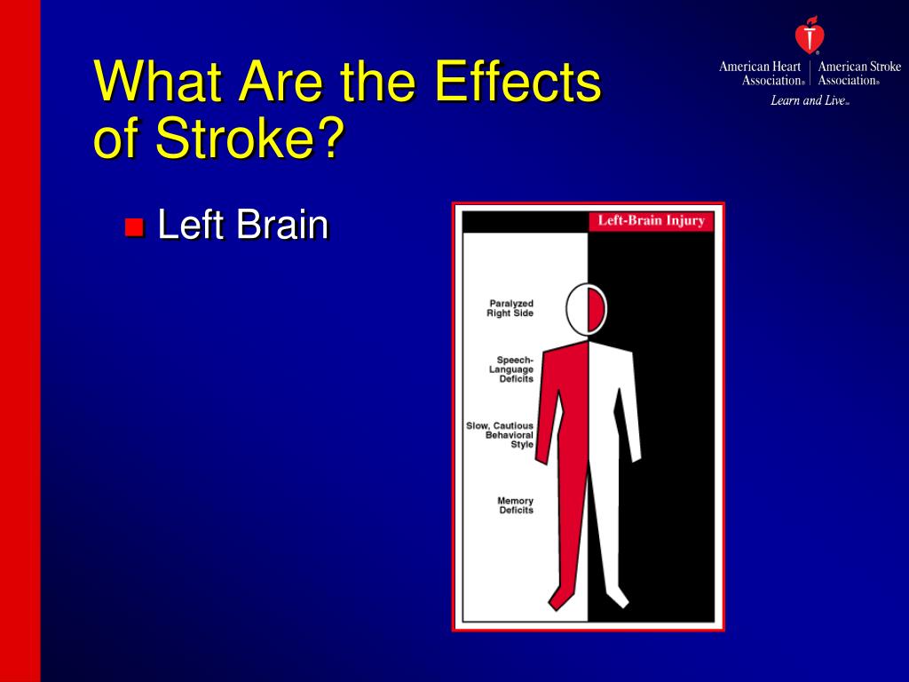 after effects of a stroke after effects of a stroke