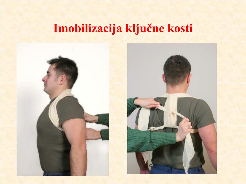 PPT - IMOBILIZACIJA POMOĆU TROKUTNE MARAME PowerPoint Presentation, free  download - ID:4450880