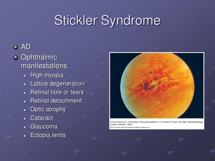 PPT - Vitreous and Retina Pediatric Ophthalmology PowerPoint