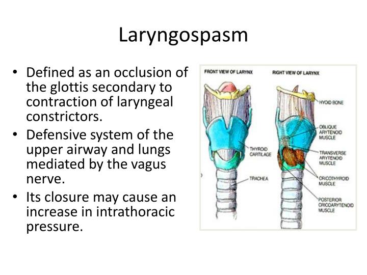 PPT - Laryngeal Spasm And Negative Pressure Pulmonary Edema PowerPoint ...