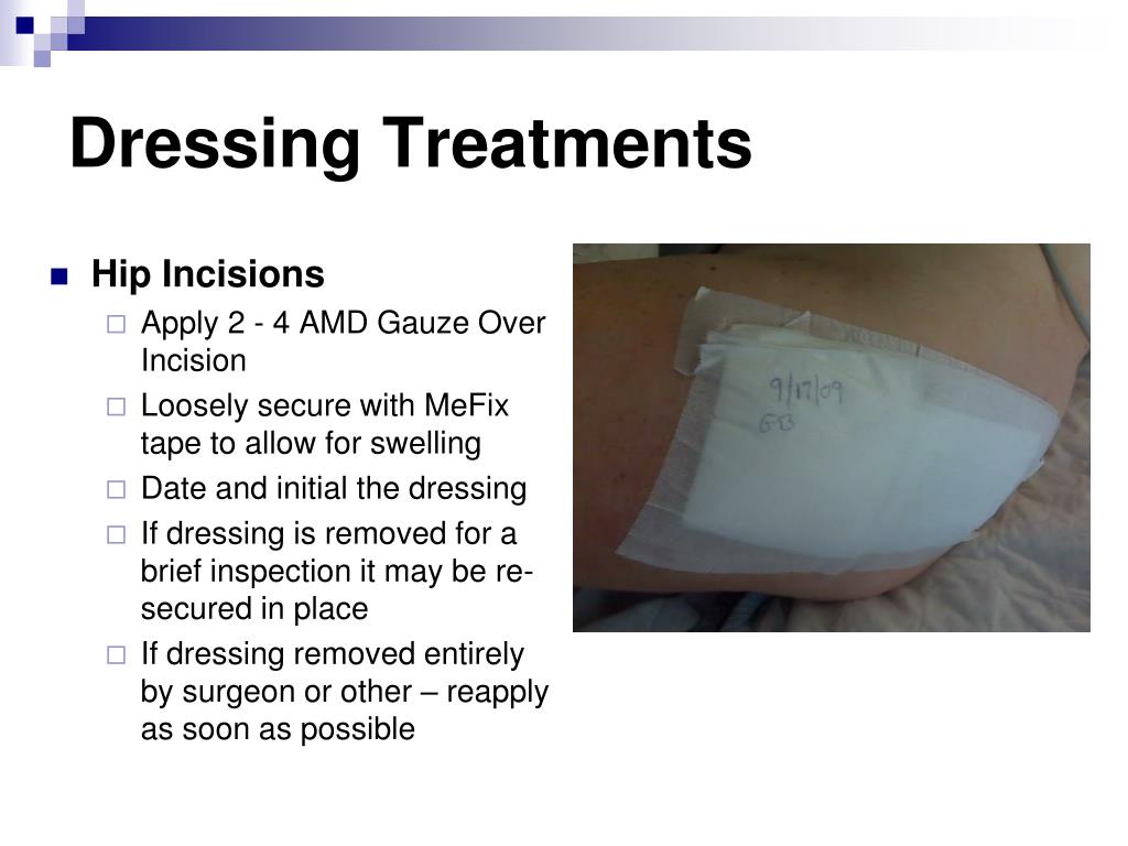 PPT - Establish a Culture of Safety: Working Toward Zero Surgical Site ...