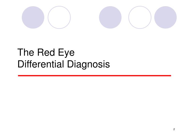 PPT RED EYE PowerPoint Presentation ID4462263