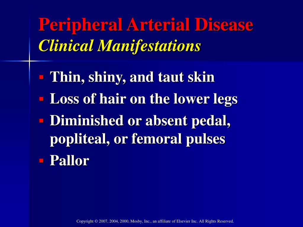 PPT - Focus on Peripheral Arterial Disease of the Lower Extremities ...