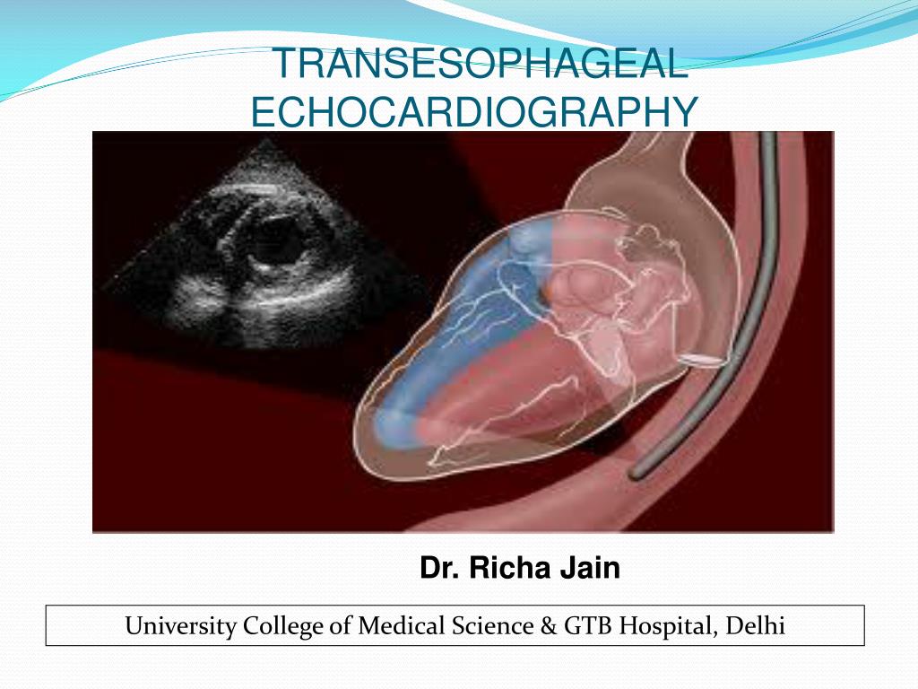 Transesophageal Echocardiogram (TEE)