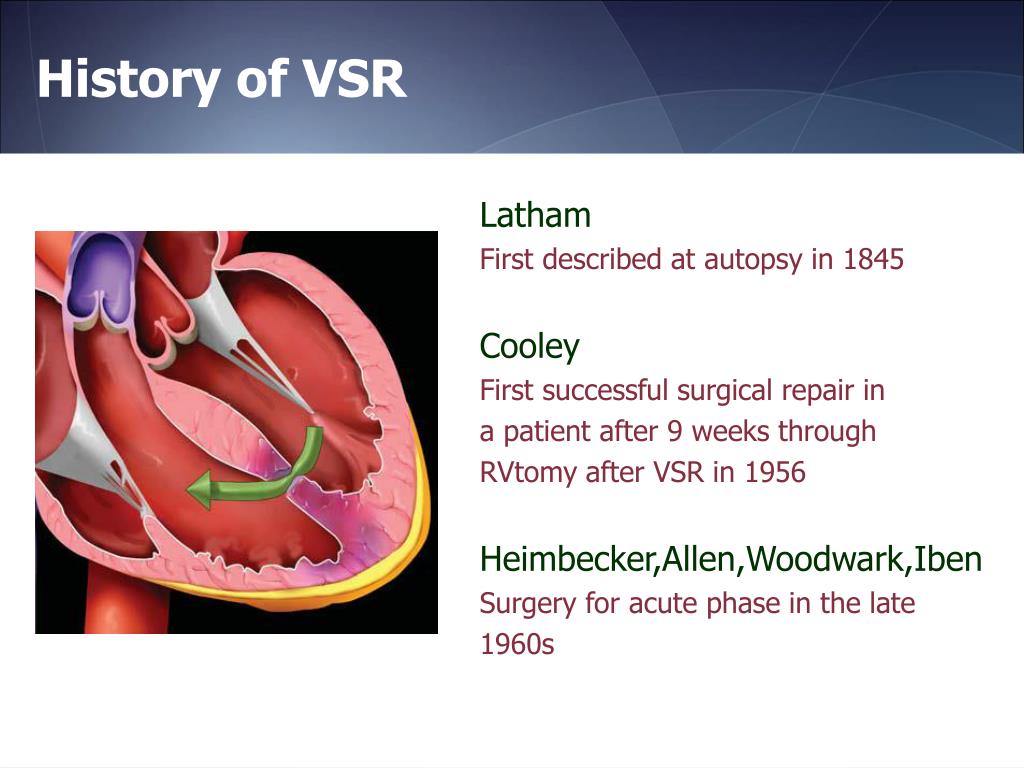 PPT Post infarction Ventricular Septal Rupture and Free Wall Rupture PPT Post infarction Ventricular Septal Rupture and Free Wall Rupture