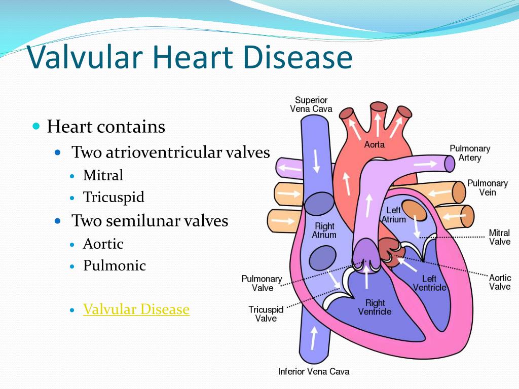 Ppt Valvular Heart Disease Cardiomyopathy And Aneursyms Powerpoint
