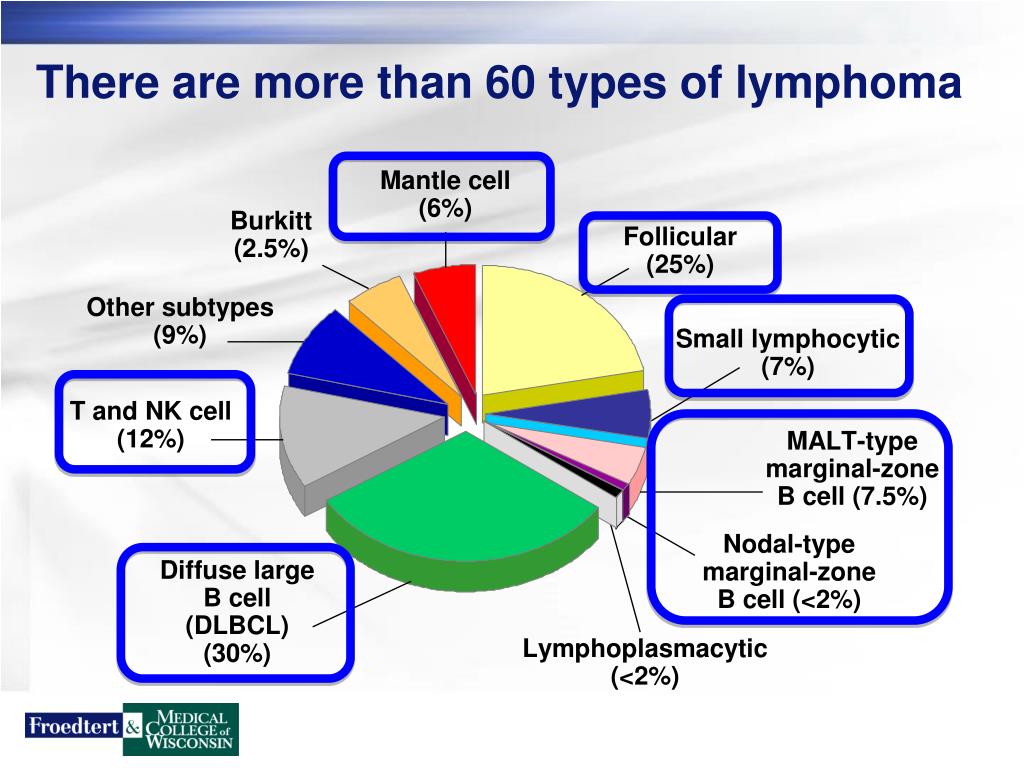 presentation of lymphomas