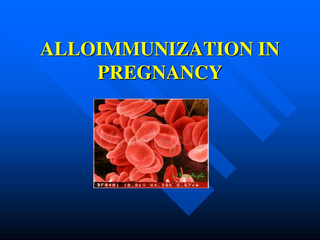 educational topic 19 alloimmunization